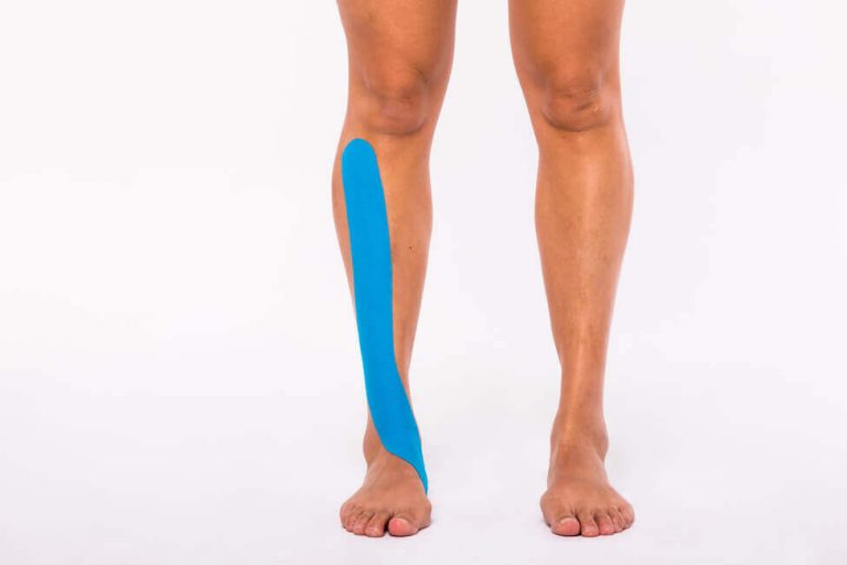 Kinesiotaping